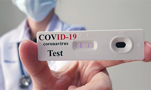 Sembra che i test sierologici saranno vietati in Sardegna!