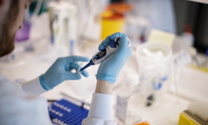 Il vaccino di Oxford genera una grande risposta immunitaria negli anziani