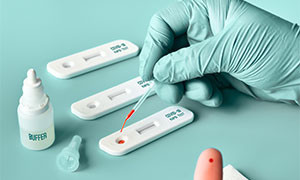 L'anticorpo monoclonale pronto per il 2021