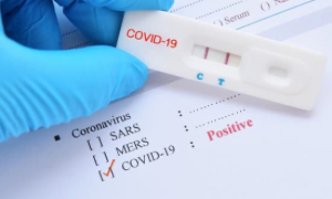 In Arrivo In Sardegna 2 Milioni Di Test Antigenici Rapidi