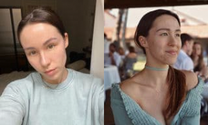 Aurora Ramazzotti: &ldquo;Basta lotte contro l&rsquo;acne, sono serena&rdquo;