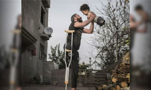 Mobilitazione per il bimbo siriano senza arti: parte una raccolta fondi per cure e ospitalit&agrave;