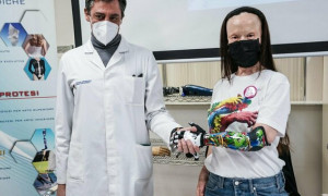 Da oggi la sarda Valentina Pitzalis ha una mano bionica