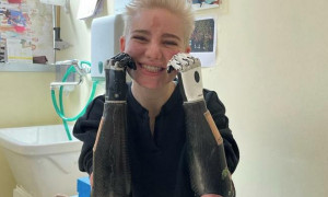 Bebe Vio mostra le sue protesi ipertecnologiche: &quot;Evvai, ecco mani e piedi nuovi&quot;