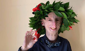 Sammy Basso &egrave; il malato di progeria pi&ugrave; longevo del mondo: &quot;Prendo otto pillole al giorno&quot;