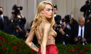 Cara Delevingne non nasconde la psoriasi al Met Gala: &ldquo;Amatevi cos&igrave; come siete&rdquo;