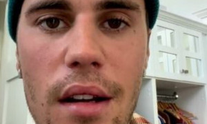 Justin Bieber: &quot;Ho una paralisi al volto, ecco perch&eacute; ho fermato il tour&quot;