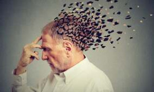 Alzheimer, autorizzato negli USA un nuovo farmaco che ne rallenta il declino