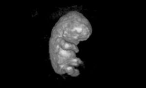 Intelligenza artificiale: creato il primo ologramma 3D di un embrione che cresce