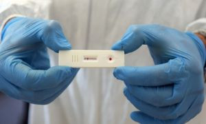 Test Covid a prezzi pi&ugrave; alti: possibile danno di 3,5 milioni di euro