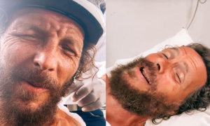 Brutta caduta dalla bici per Jovanotti, si rompe femore e clavicola