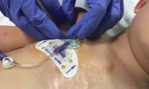 Microcitemico, Asl Cagliari : &ldquo;La notizia divulgata a mezzo stampa &eacute; falsa&rdquo;