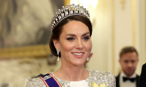 Kate Middleton Sottoposta a un Intervento: preoccupazione e ipotesi tra i sudditi