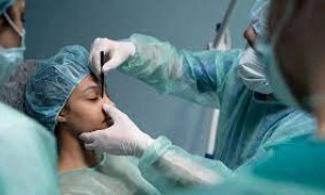 Bonus chirurgia estetica: cos'&egrave;, a chi spetta e come funziona