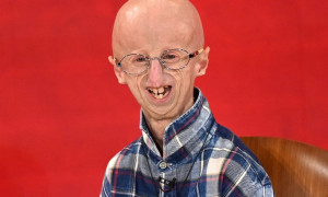 Morte di Sammy Basso, si potrebbe avviare il processo di beatificazione