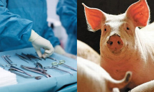 I cattolici possono ricevere trapianti di organi animali