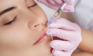 Botox e filler, sempre pi&ugrave; italiani ricorrono ai trattamenti estetici