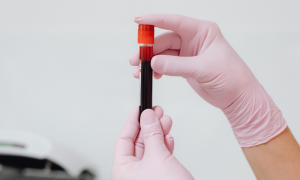 Giappone, il sangue artificiale universale pu&ograve; rivoluzionare la medicina trasfusionale